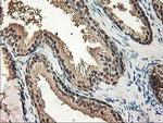 ALS2CR1 Antibody in Immunohistochemistry (Paraffin) (IHC (P))