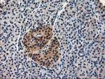 ALS2CR1 Antibody in Immunohistochemistry (Paraffin) (IHC (P))