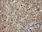 ALS2CR1 Antibody in Immunohistochemistry (Paraffin) (IHC (P))