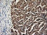 ALS2CR1 Antibody in Immunohistochemistry (Paraffin) (IHC (P))