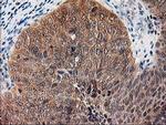 ALS2CR1 Antibody in Immunohistochemistry (Paraffin) (IHC (P))