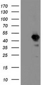 ALS2CR1 Antibody in Western Blot (WB)