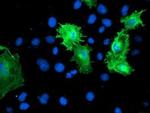 Calponin 2 Antibody in Immunocytochemistry (ICC/IF)