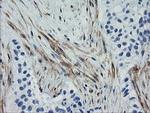 Calponin 2 Antibody in Immunohistochemistry (Paraffin) (IHC (P))