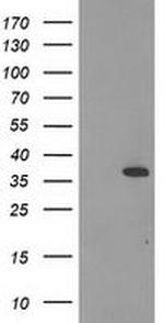 Calponin 2 Antibody in Western Blot (WB)