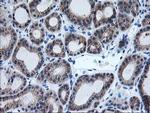 AIPL1 Antibody in Immunohistochemistry (Paraffin) (IHC (P))