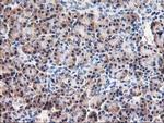 AIPL1 Antibody in Immunohistochemistry (Paraffin) (IHC (P))