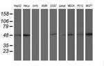 AIPL1 Antibody in Western Blot (WB)