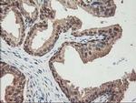 ALS2CR1 Antibody in Immunohistochemistry (Paraffin) (IHC (P))