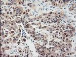 ALS2CR1 Antibody in Immunohistochemistry (Paraffin) (IHC (P))