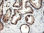 ALS2CR1 Antibody in Immunohistochemistry (Paraffin) (IHC (P))