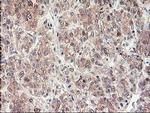 ALS2CR1 Antibody in Immunohistochemistry (Paraffin) (IHC (P))