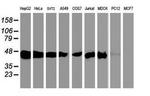 SEC14L2 Antibody in Western Blot (WB)