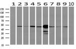 SEC14L2 Antibody in Western Blot (WB)