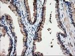 NUBPL Antibody in Immunohistochemistry (Paraffin) (IHC (P))