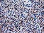 NUBPL Antibody in Immunohistochemistry (Paraffin) (IHC (P))