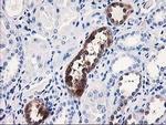 NUBPL Antibody in Immunohistochemistry (Paraffin) (IHC (P))