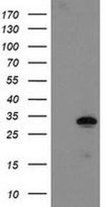 NUBPL Antibody in Western Blot (WB)