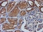 NUBPL Antibody in Immunohistochemistry (Paraffin) (IHC (P))