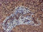 NUBPL Antibody in Immunohistochemistry (Paraffin) (IHC (P))