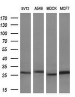 Latexin Antibody in Western Blot (WB)