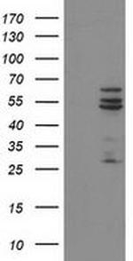 CYP2C9 Antibody in Western Blot (WB)