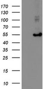 HARS2 Antibody in Western Blot (WB)