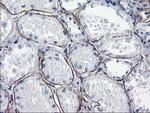 LDLRAP1 Antibody in Immunohistochemistry (Paraffin) (IHC (P))