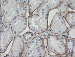 LDLRAP1 Antibody in Immunohistochemistry (Paraffin) (IHC (P))