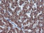 CYP2A6 Antibody in Immunohistochemistry (Paraffin) (IHC (P))