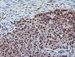 CYP2A6 Antibody in Immunohistochemistry (Paraffin) (IHC (P))