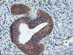 CYP2A6 Antibody in Immunohistochemistry (Paraffin) (IHC (P))