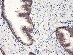 HARS2 Antibody in Immunohistochemistry (Paraffin) (IHC (P))