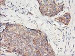 HARS2 Antibody in Immunohistochemistry (Paraffin) (IHC (P))