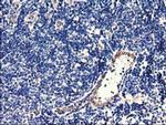 CENPH Antibody in Immunohistochemistry (Paraffin) (IHC (P))