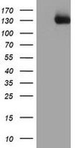 PTK7 Antibody in Western Blot (WB)