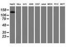 PTK7 Antibody in Western Blot (WB)