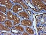 PDSS2 Antibody in Immunohistochemistry (Paraffin) (IHC (P))