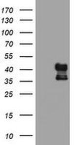 PDSS2 Antibody in Western Blot (WB)