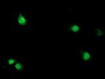 SDS Antibody in Immunocytochemistry (ICC/IF)