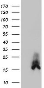 DUSP23 Antibody in Western Blot (WB)