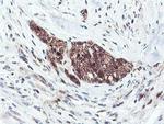 RNPEP Antibody in Immunohistochemistry (Paraffin) (IHC (P))