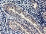 PDSS2 Antibody in Immunohistochemistry (Paraffin) (IHC (P))