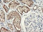 PDSS2 Antibody in Immunohistochemistry (Paraffin) (IHC (P))