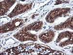 CD249 Antibody in Immunohistochemistry (Paraffin) (IHC (P))