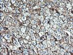 CD249 Antibody in Immunohistochemistry (Paraffin) (IHC (P))