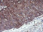 PFKP Antibody in Immunohistochemistry (Paraffin) (IHC (P))