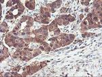 PFKP Antibody in Immunohistochemistry (Paraffin) (IHC (P))