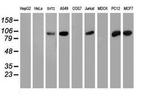 PFKP Antibody in Western Blot (WB)