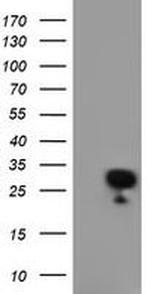 RGS16 Antibody in Western Blot (WB)